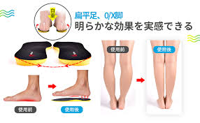 O脚矯正用インソール